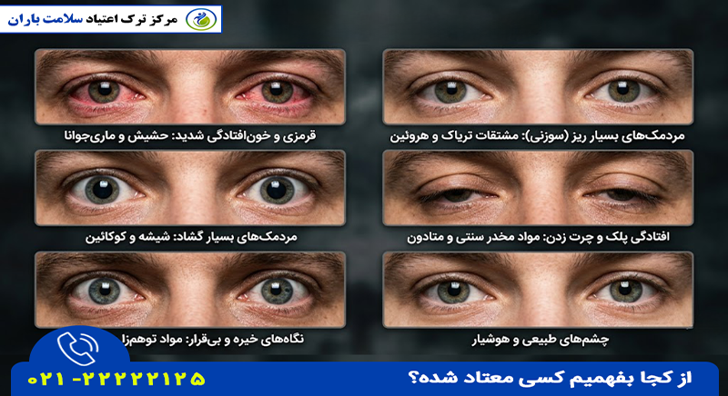 تشخیص اعتیاد از ظاهر از تغییرات مردک چشم copy