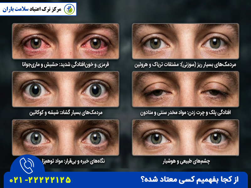 تشخیص اعتیاد از ظاهر از تغییرات مردک چشم